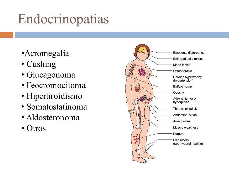 cura de la diabetes somatostatinoma